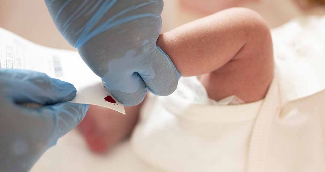 Drépanocytose : tous les nouveau-nés bientôt dépistés ?