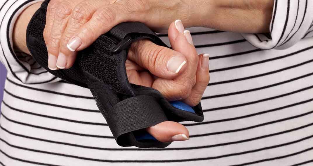 « Une orthèse peut-elle soulager les douleurs de l’arthrose de la main ? » Sidonie, 61 ans