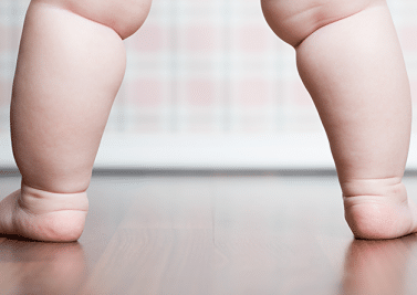 Obésité de l’enfant : quand faut-il s’inquiéter ?