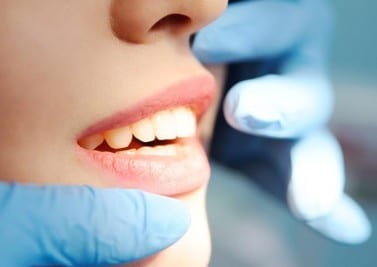 Des dents mal alignées nuisent à notre santé