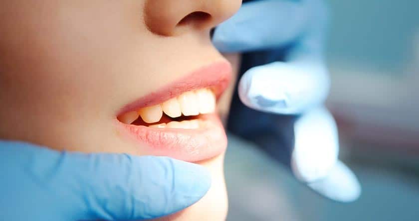 Des dents mal alignées nuisent à notre santé