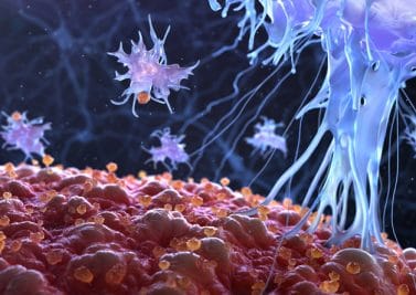 Cancer : tous sauvés par l’immunothérapie ?
