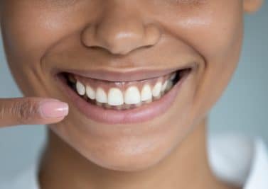Les dents, miroir de notre bonne santé…
